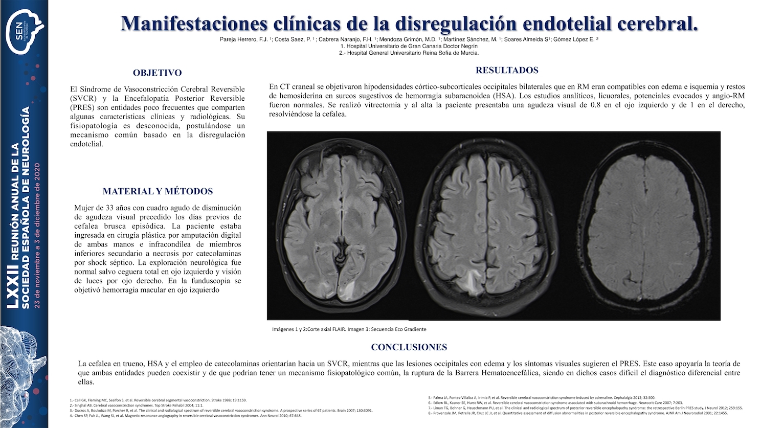 Manifestaciones clínicas de la disregulación endotelial cerebral