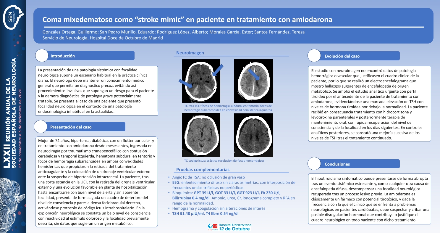 Coma mixedematoso como “stroke mimic” en paciente en tratamiento con amiodarona