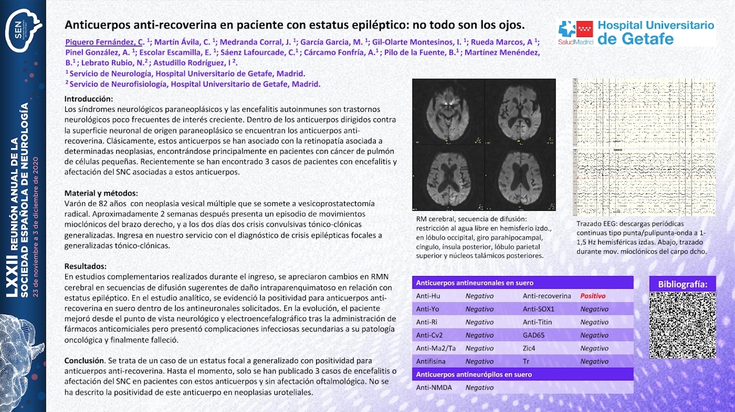 Anticuerpos antirecoverina en paciente con estatus epiléptico: no todo son los ojos