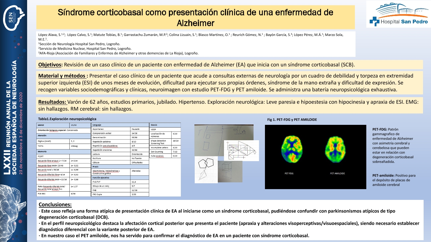 Síndrome corticobasal como presentación clínica de una enfermedad de Alzheimer