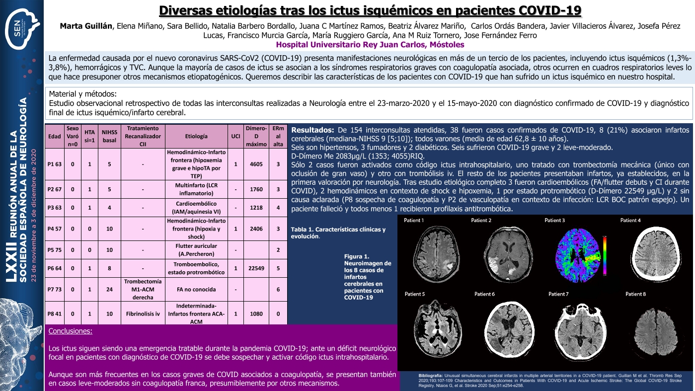 Diversas etiologías tras los ictus isquémicos en pacientes COVID-19