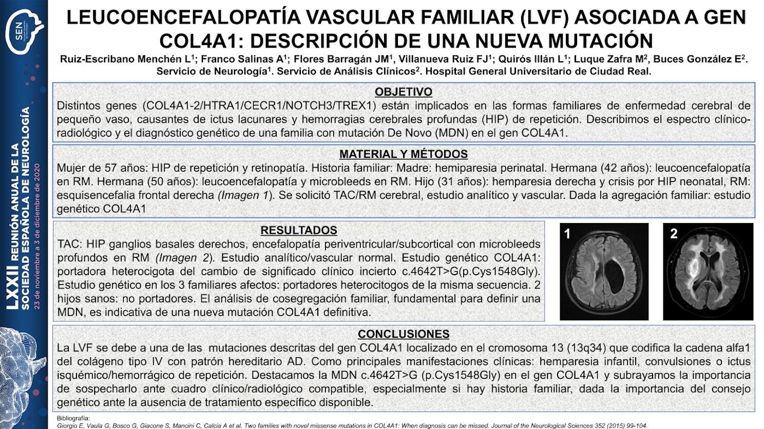 Leucoencefalopatía vascular familiar (LVF) asociada a gen COL4A1: Descripción de una nueva mutación