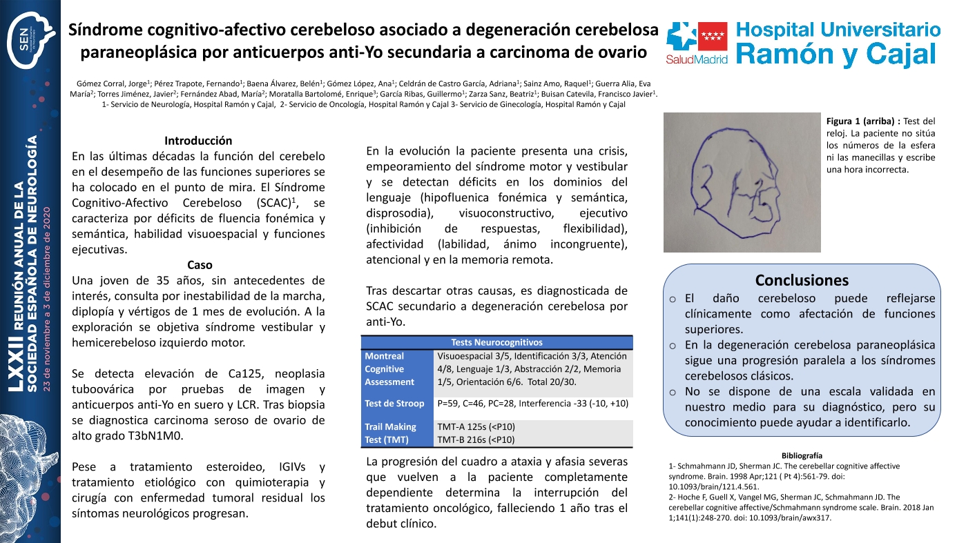 Síndrome cognitivo-afectivo cerebeloso asociado a degeneración cerebelosa paraneoplásica por anticuerpos anti-Yo secundaria a carcinoma de ovario