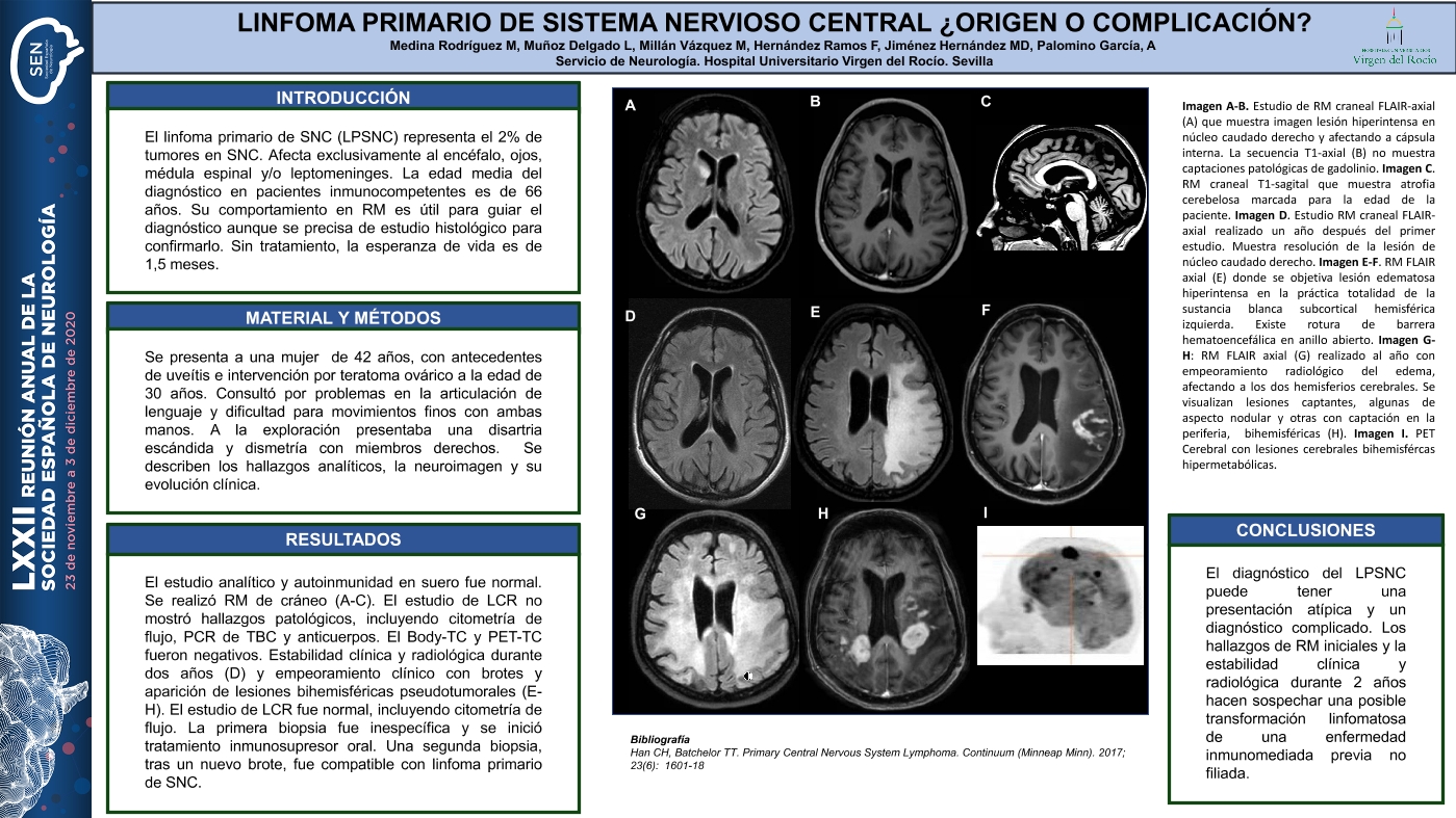 Linfoma primario de sistema nervioso central: ¿origen o complicación?