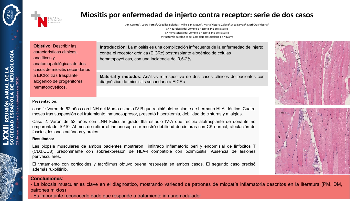 Miositis por enfermedad de injerto contra receptor: serie de dos casos