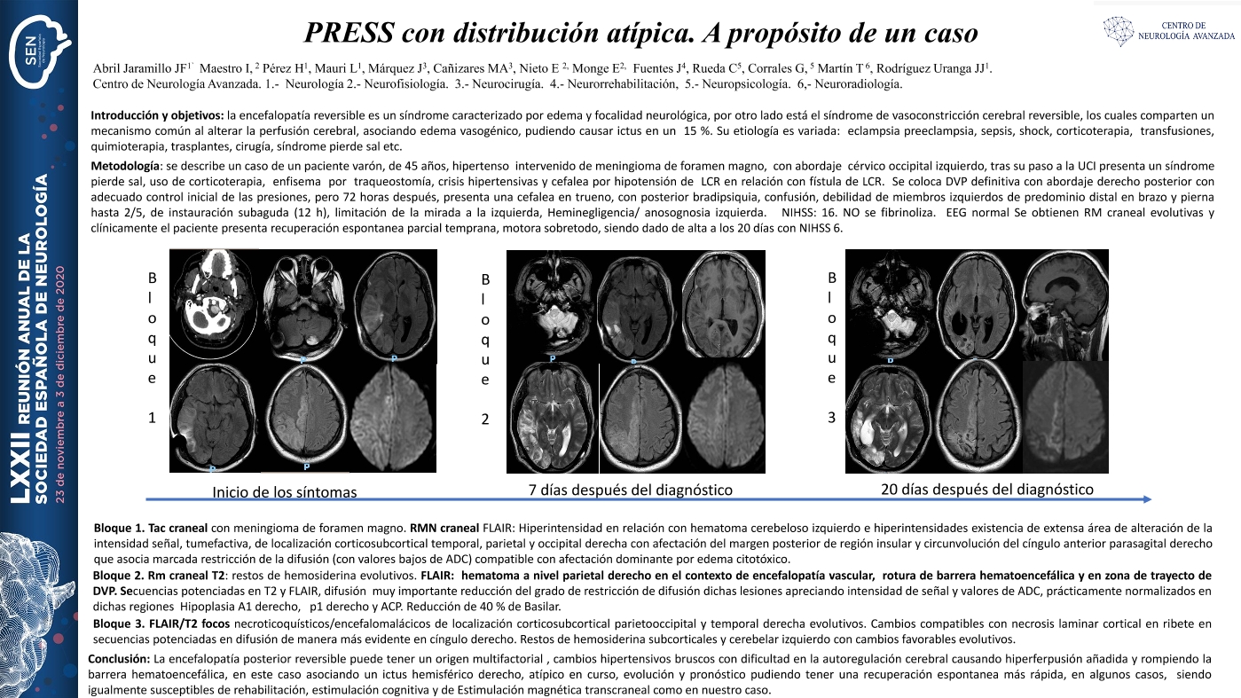 PRESS con distrubución atípica. A propósito de un caso