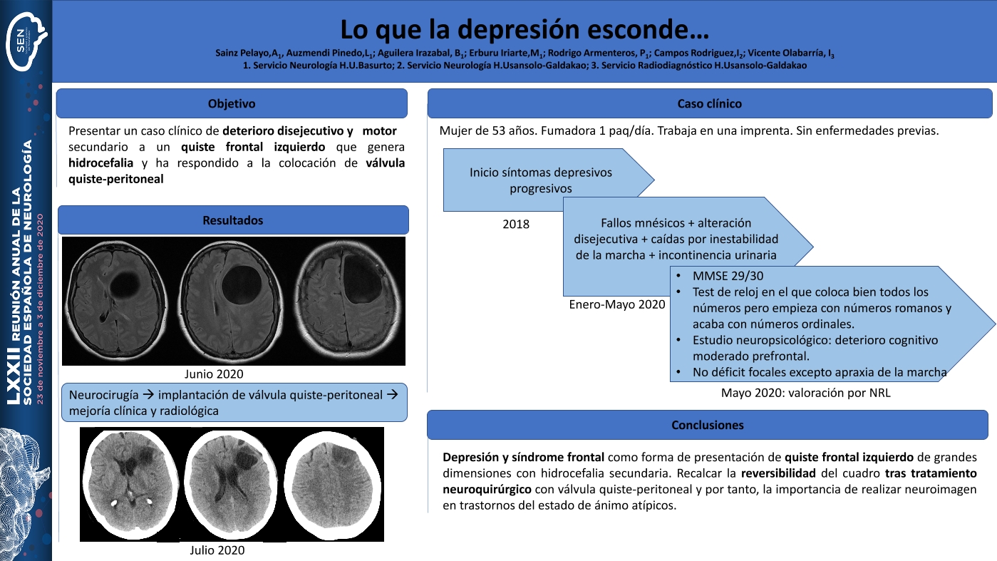 Lo que la depresión esconde