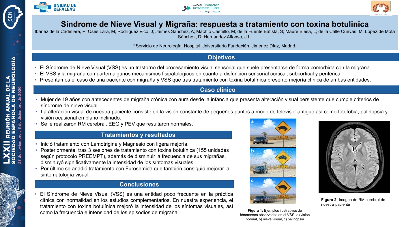 Síndrome de Nieve Visual y Migraña: respuesta a tratamiento con toxina botulinica
