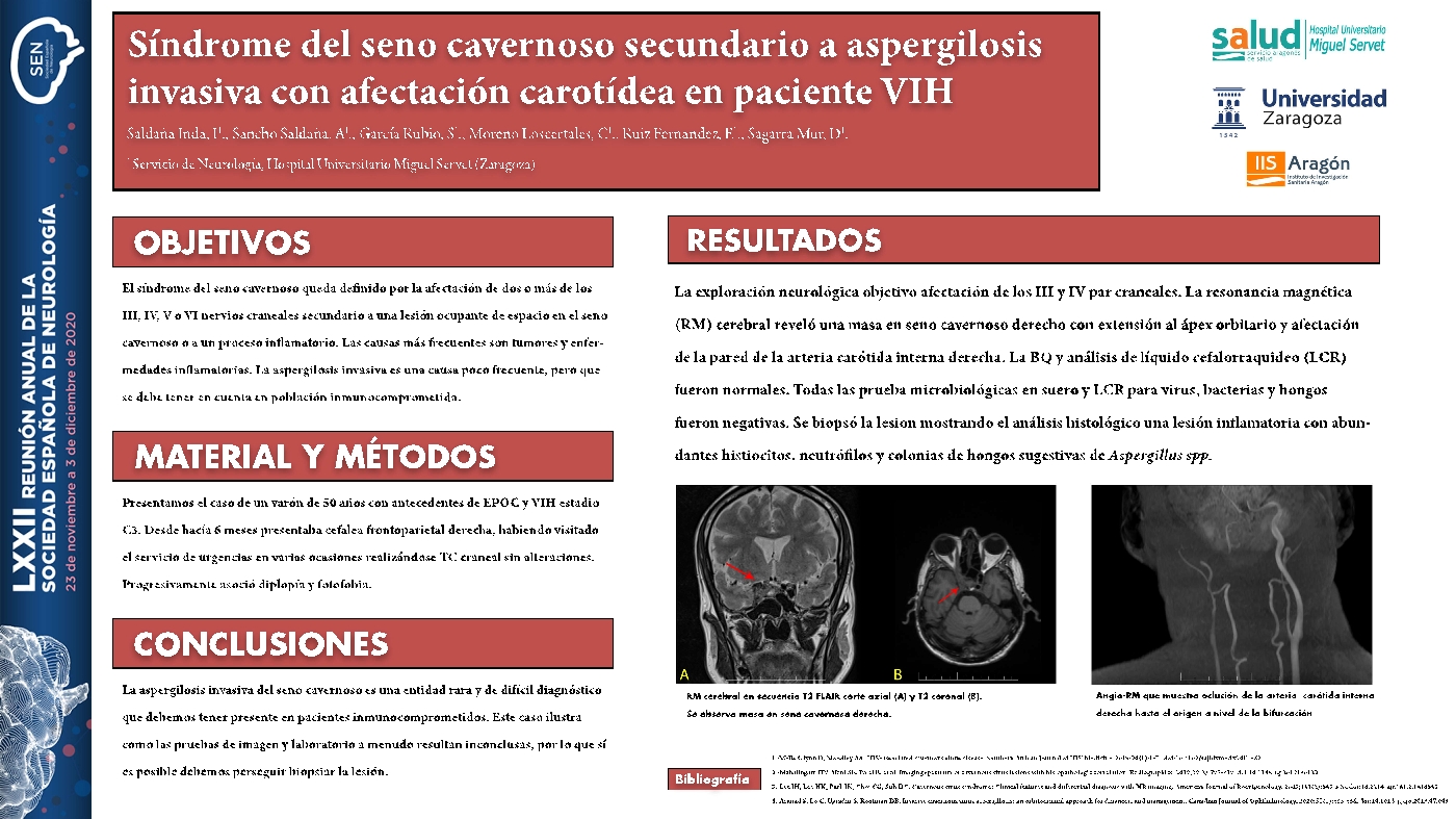 Síndrome de seno cavernoso secundario a aspergiloma invasivo con afectación carotídea en paciente con VIH