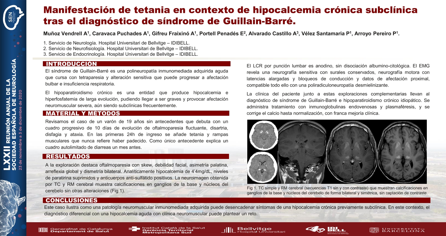 Manifestación de tetania en contexto de hipocalcemia crónica subclínica tras el diagnóstico de síndrome de Guillain-Barré