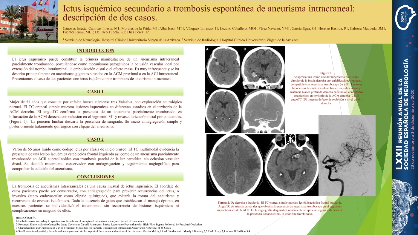 Ictus isquémico secundario a trombosis espontánea de aneurisma intracraneal: descripción de dos casos