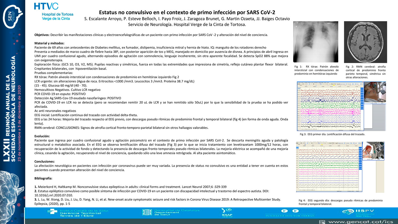Estatus no convulsivo en el contexto de primo infección por SARS CoV-2
