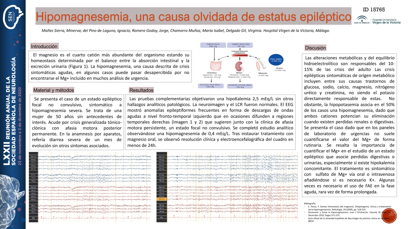Hipomagnesemia, una causa olvidada de estado epiléptico