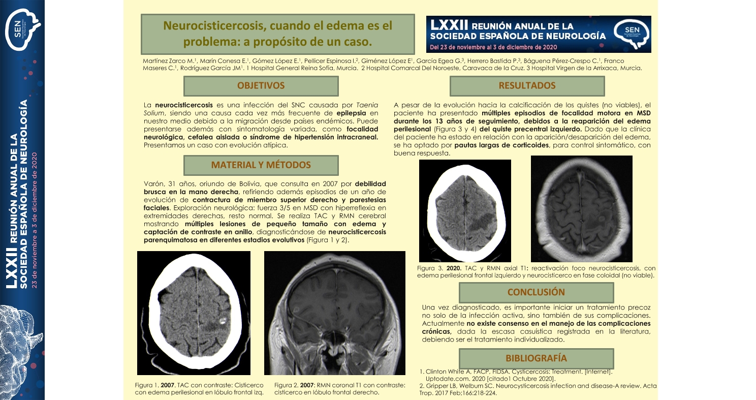 NEUROCISTICERCOSIS, CUANDO EL EDEMA ES EL PROBLEMA: A PROPÓSITO DE UN CASO.