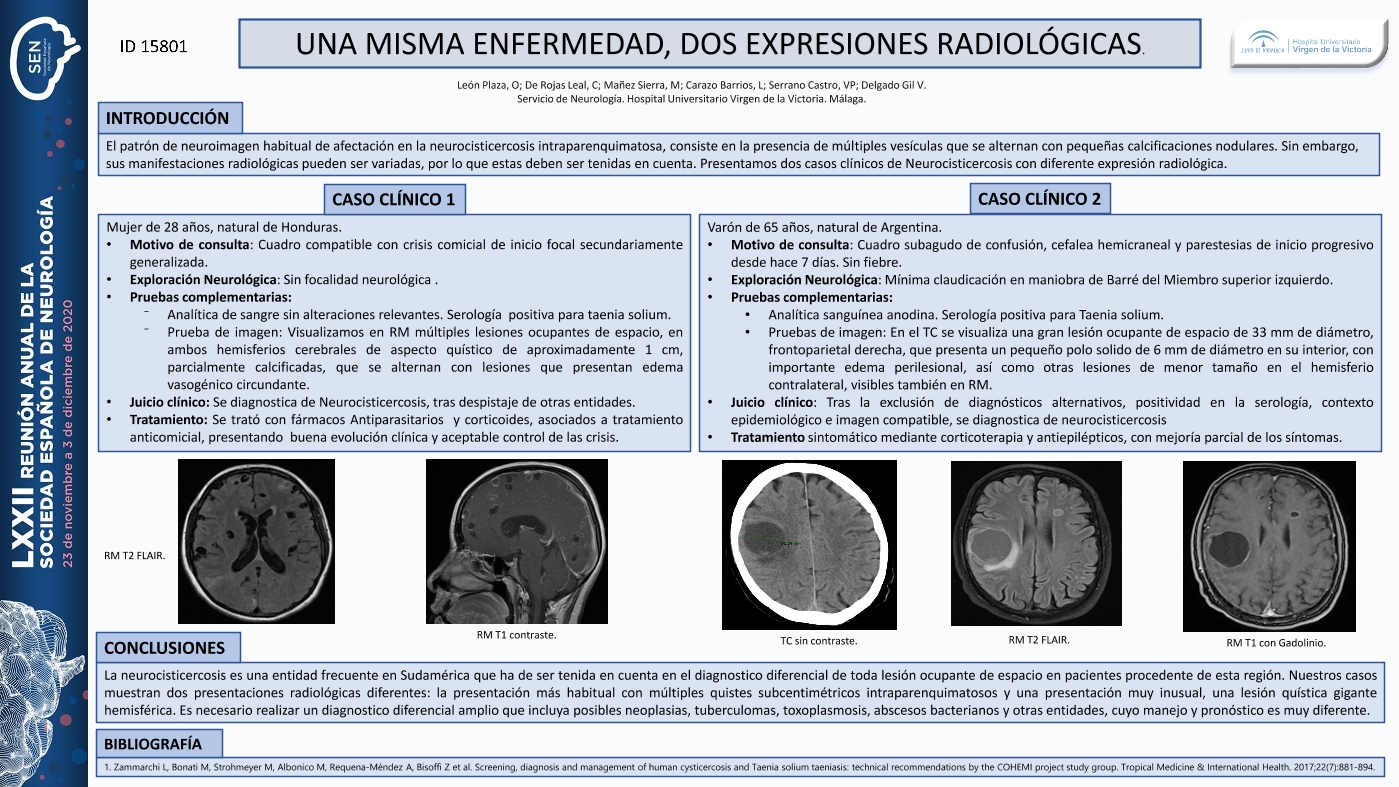 Una misma enfermedad, dos expresiones radiológicas.