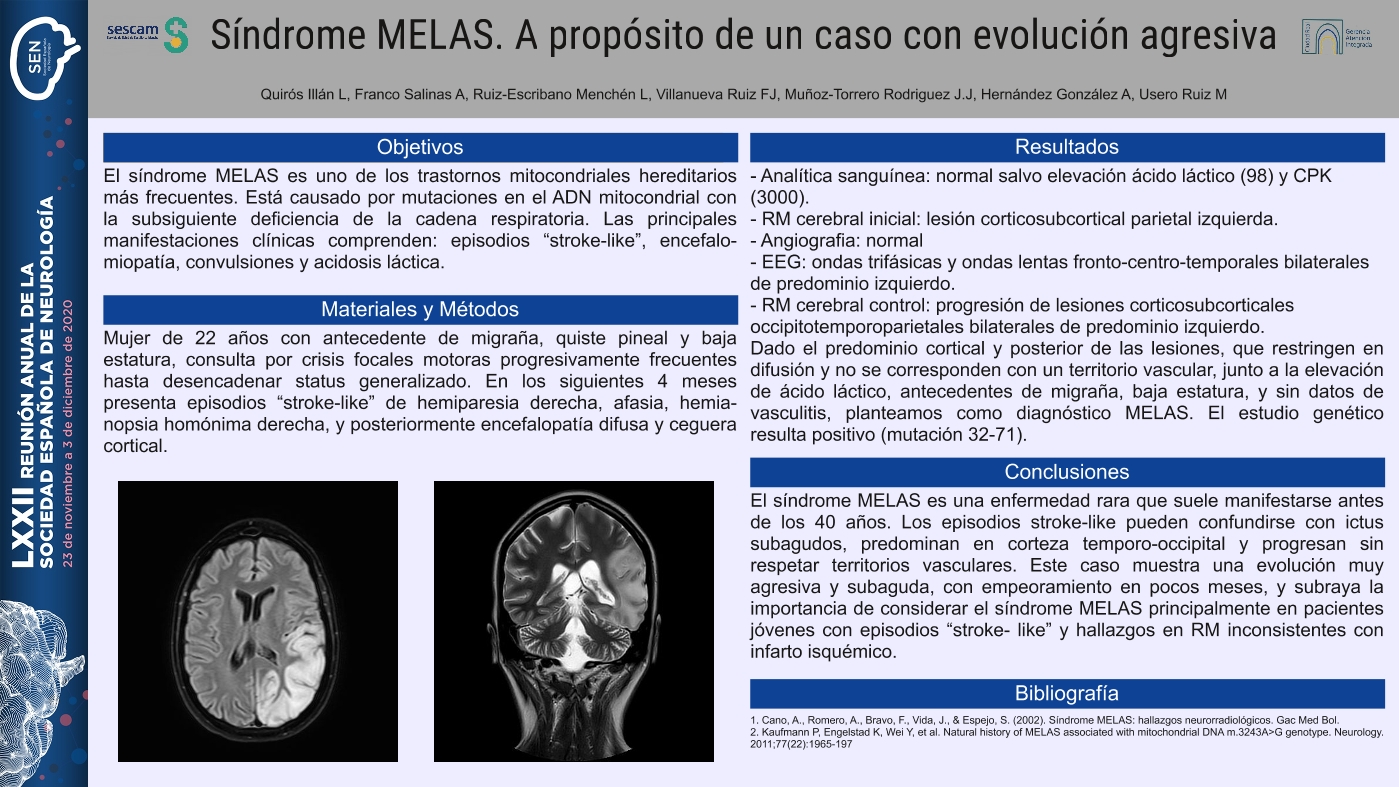 Síndrome MELAS. A propósito de un caso con evolución agresiva