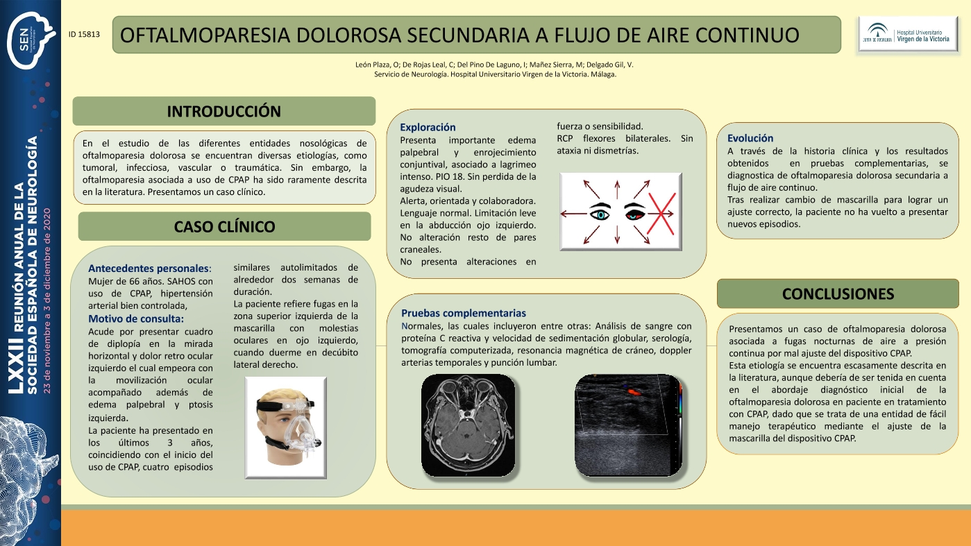 Oftalmoparesia dolorosa secundaria a flujo de aire continuo
