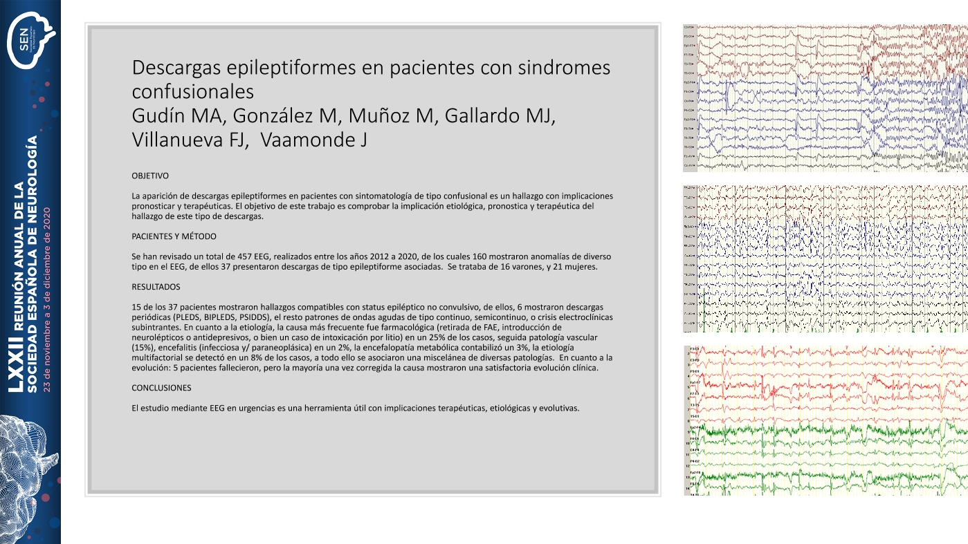 Descargas epileptiformse en pacientes con sindromes confusionales