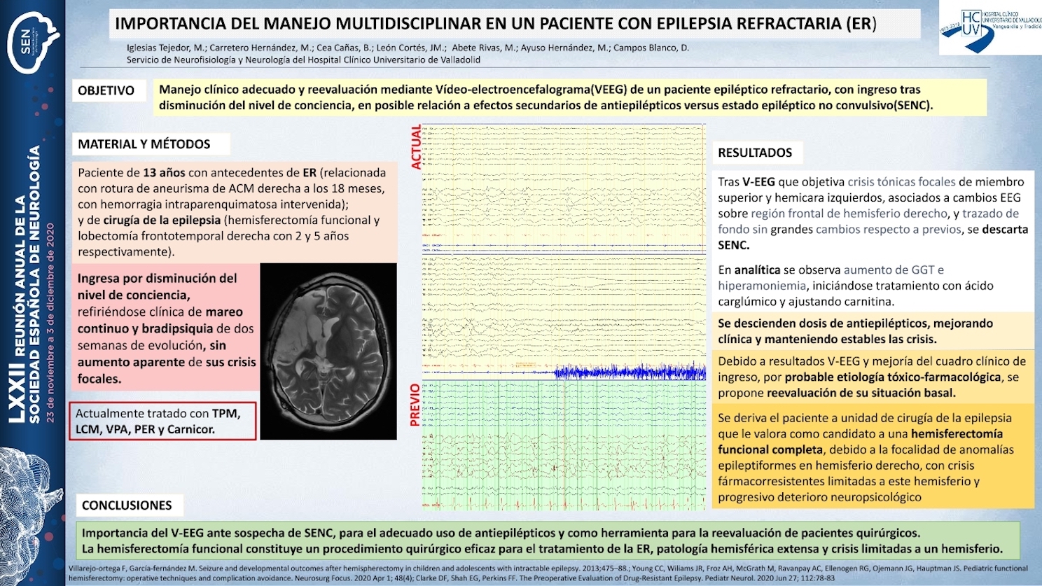 Importancia del manejo multidisciplinar en un paciente con epilepsia refractaria