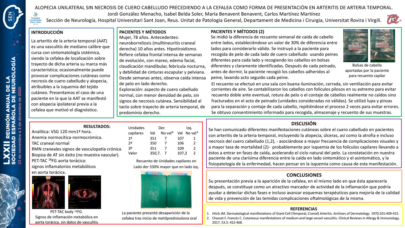 Alopecia unilateral sin necrosis de cuero cabelludo precediendo a la cefalea como forma de presentación en arteritis de arteria temporal