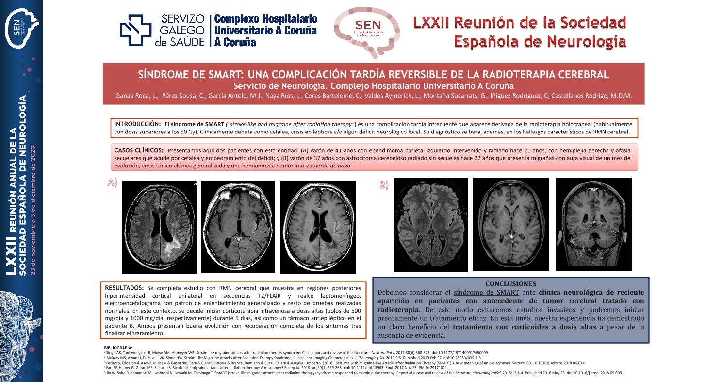 Síndrome de SMART: una complicación tardía reversible de la radioterapia cerebral