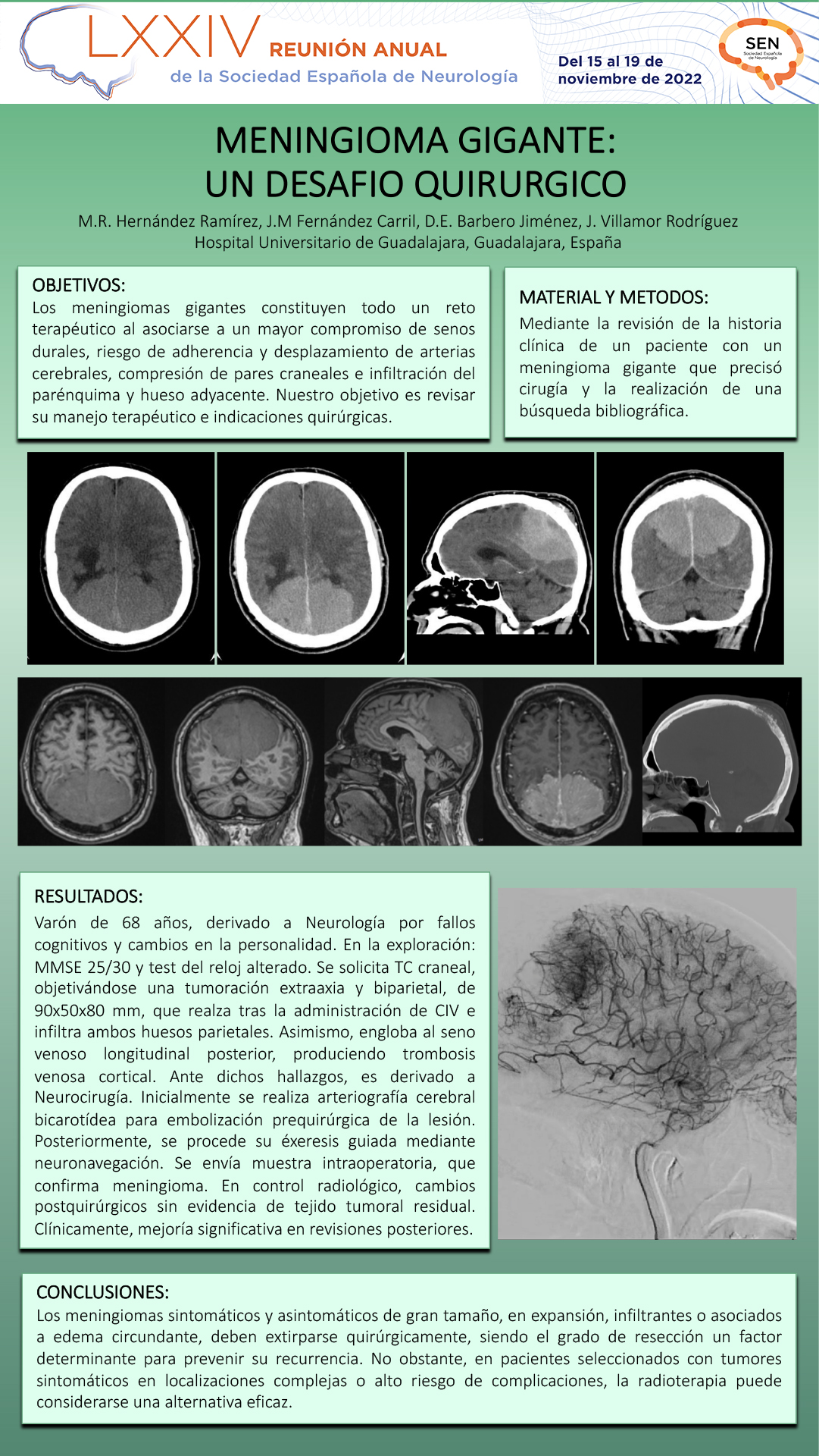 Meningioma gigante: un desafío quirúrgico
