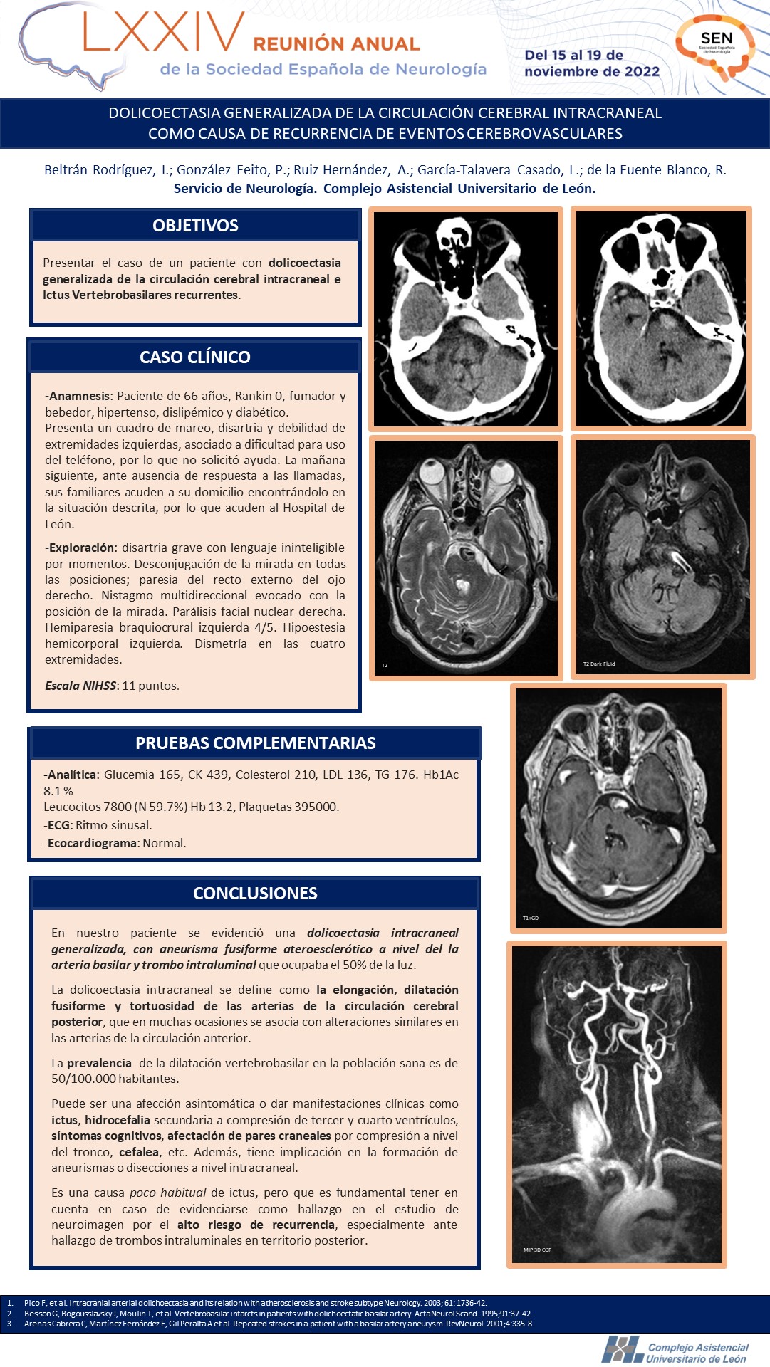 Dolicoectasia generalizada de la circulación cerebral intracraneal como causa de recurrencia de eventos cerebrovasculares