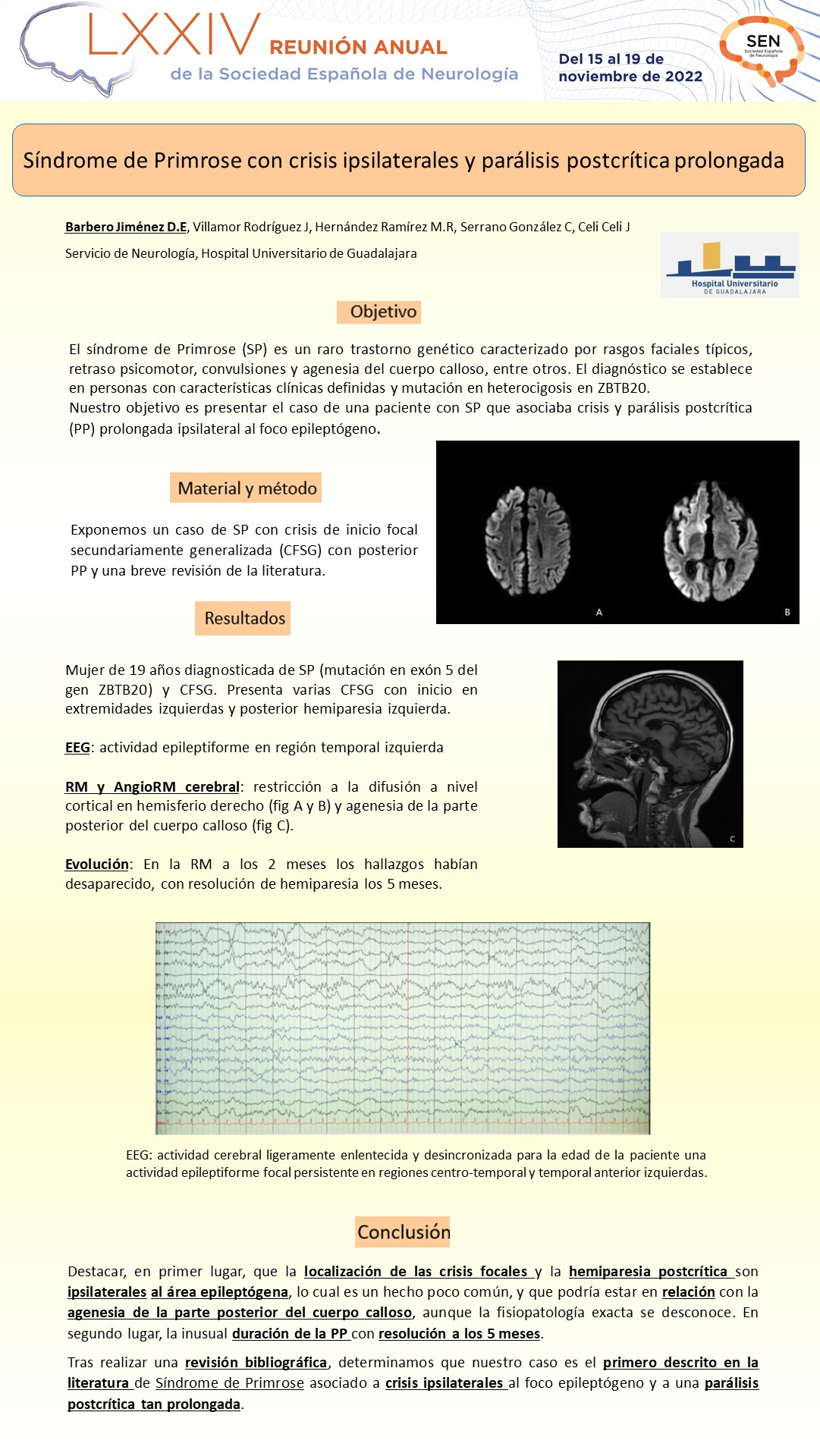 Síndrome de Primrose con crisis ipsilaterales y parálisis postcrítica prolongada