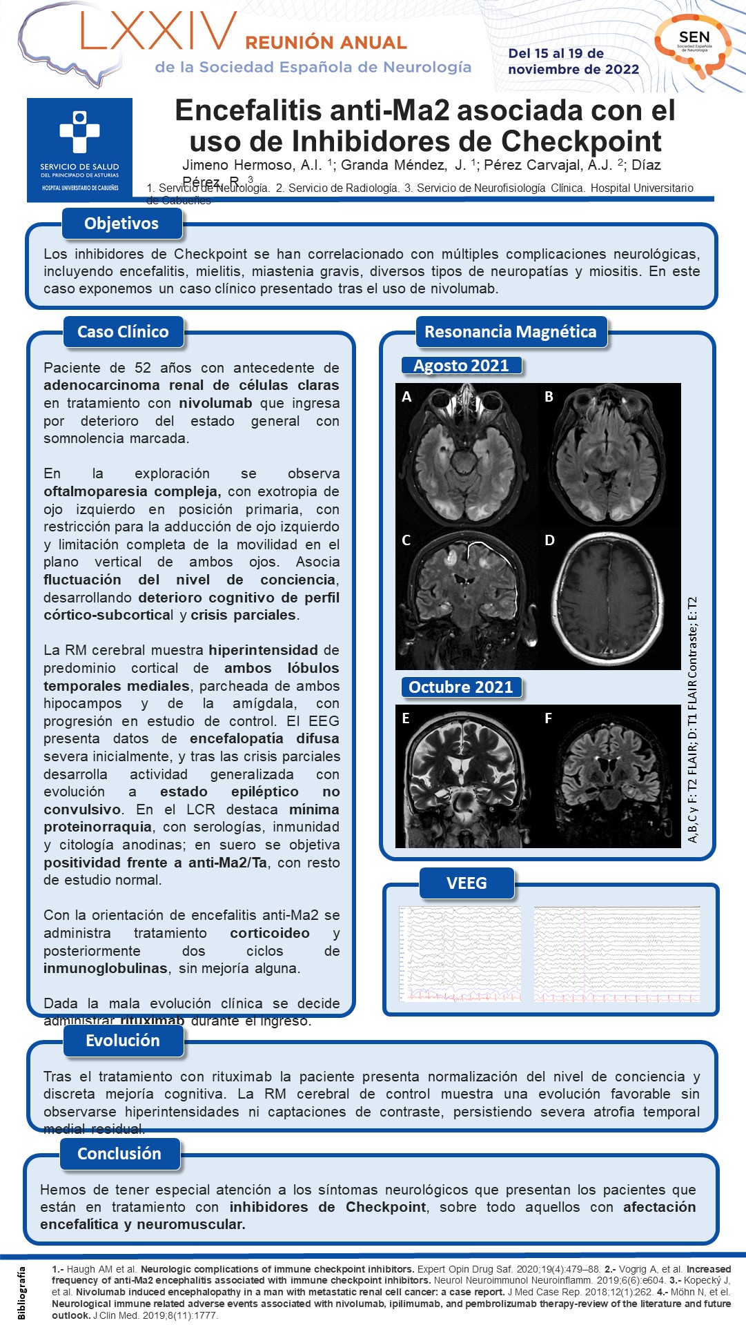 Encefalitis anti-Ma2 asociada con el uso de Inhibidores de Checkpoint