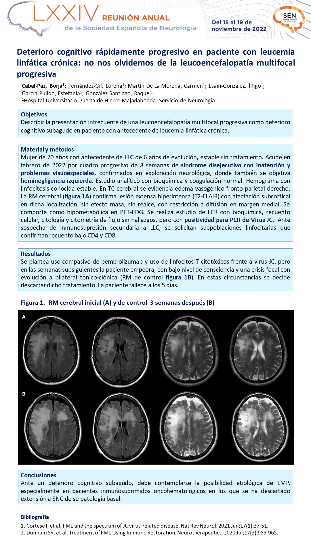 Deterioro cognitivo rápidamente progresivo en paciente con leucemia linfática crónica: no nos olvidemos de la leucoencefalopatía multifocal progresiva