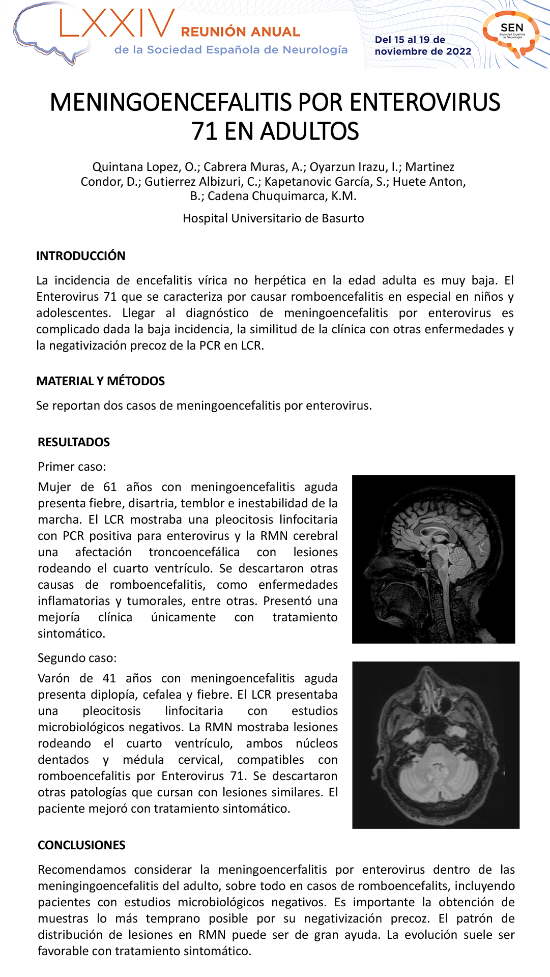 Meningoencefalitis por enterovirus 71 en adultos