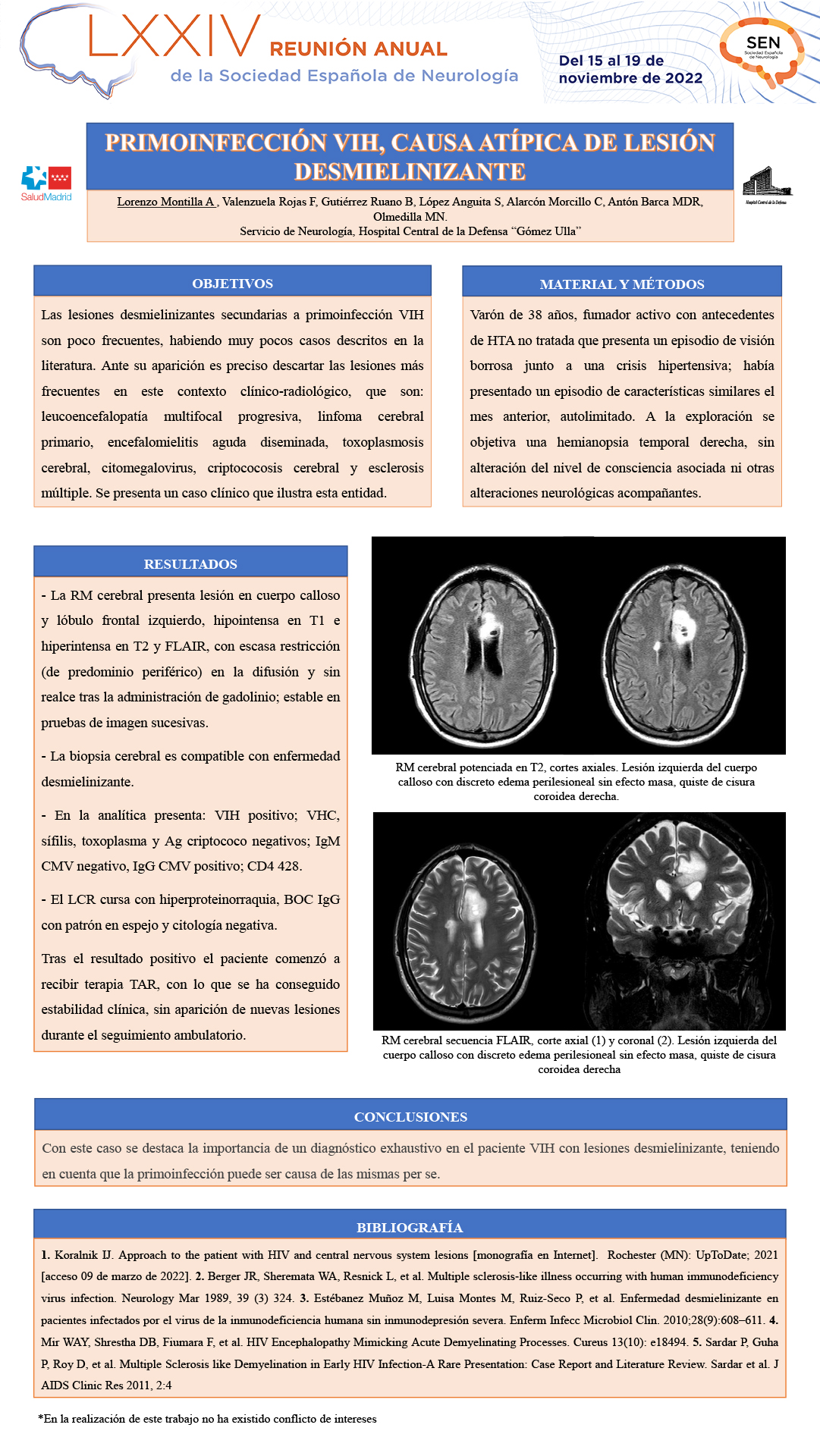 Primoinfección VIH, causa atípica de lesión desmielinizante