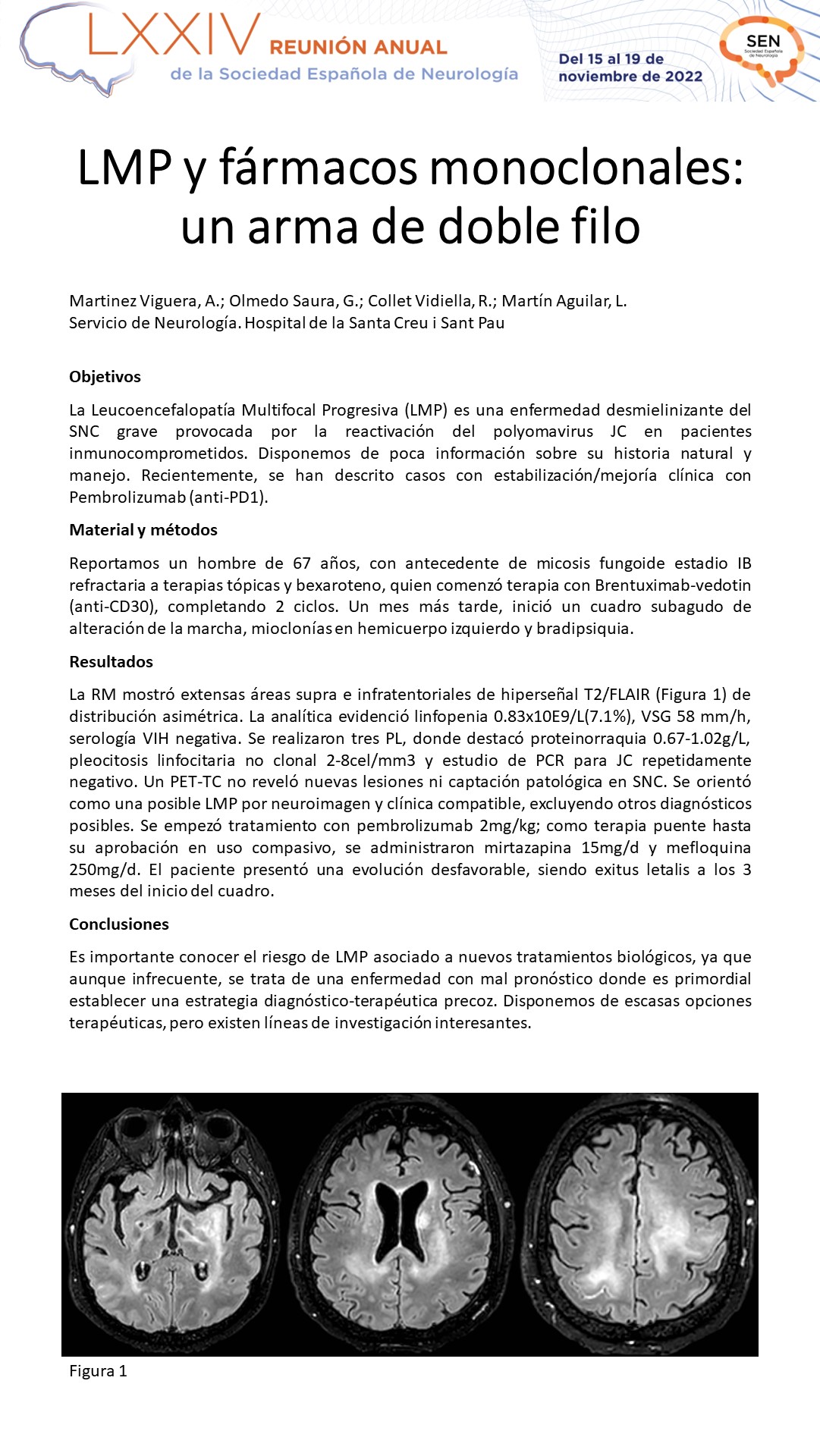 LMP y fármacos monoclonales: un arma de doble filo
