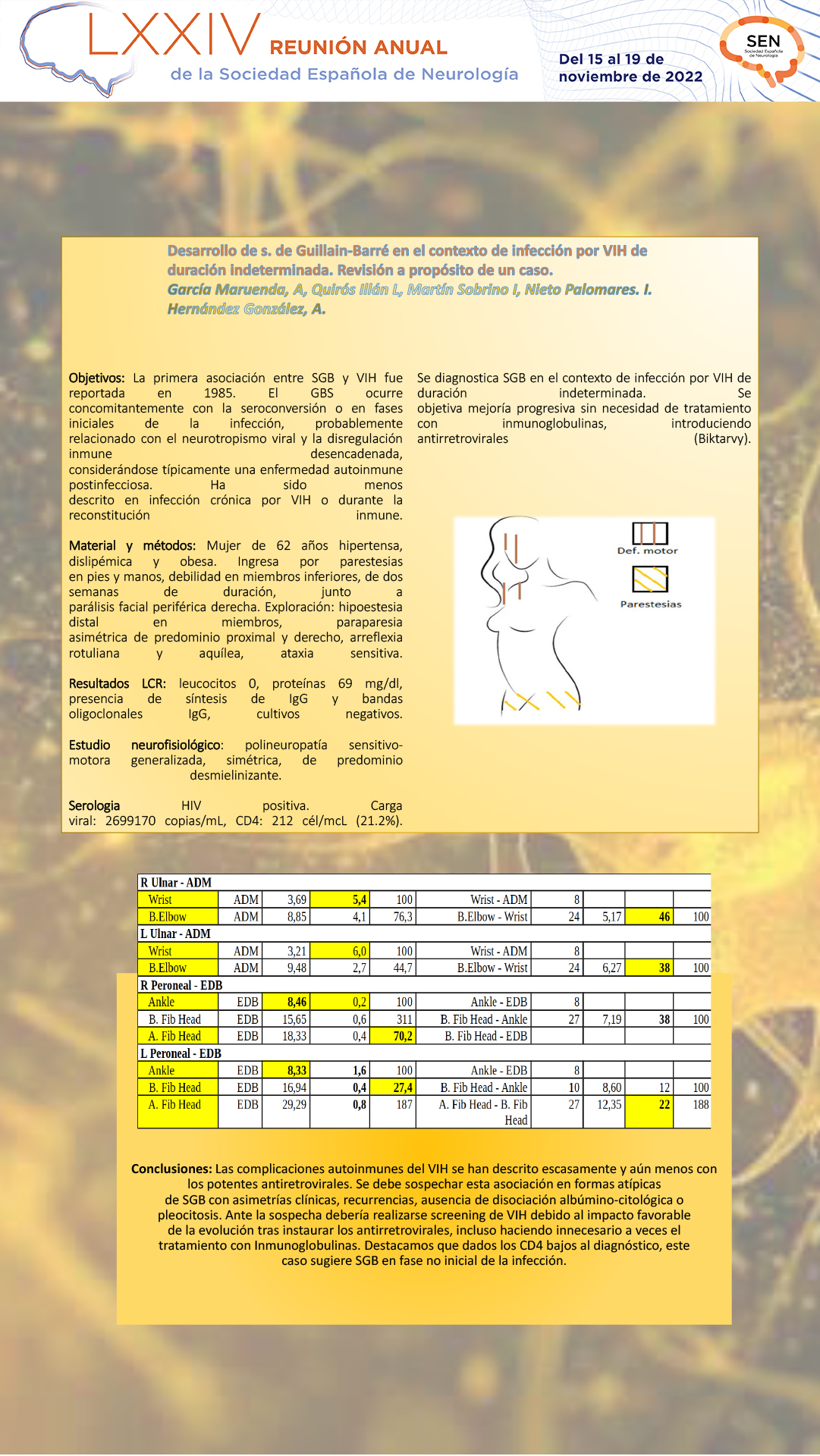 Desarrollo de síndrome de Guillain-Barré (SGB) en el contexto de infección por VIH de duración indeterminada. Revisión a propósito de un caso