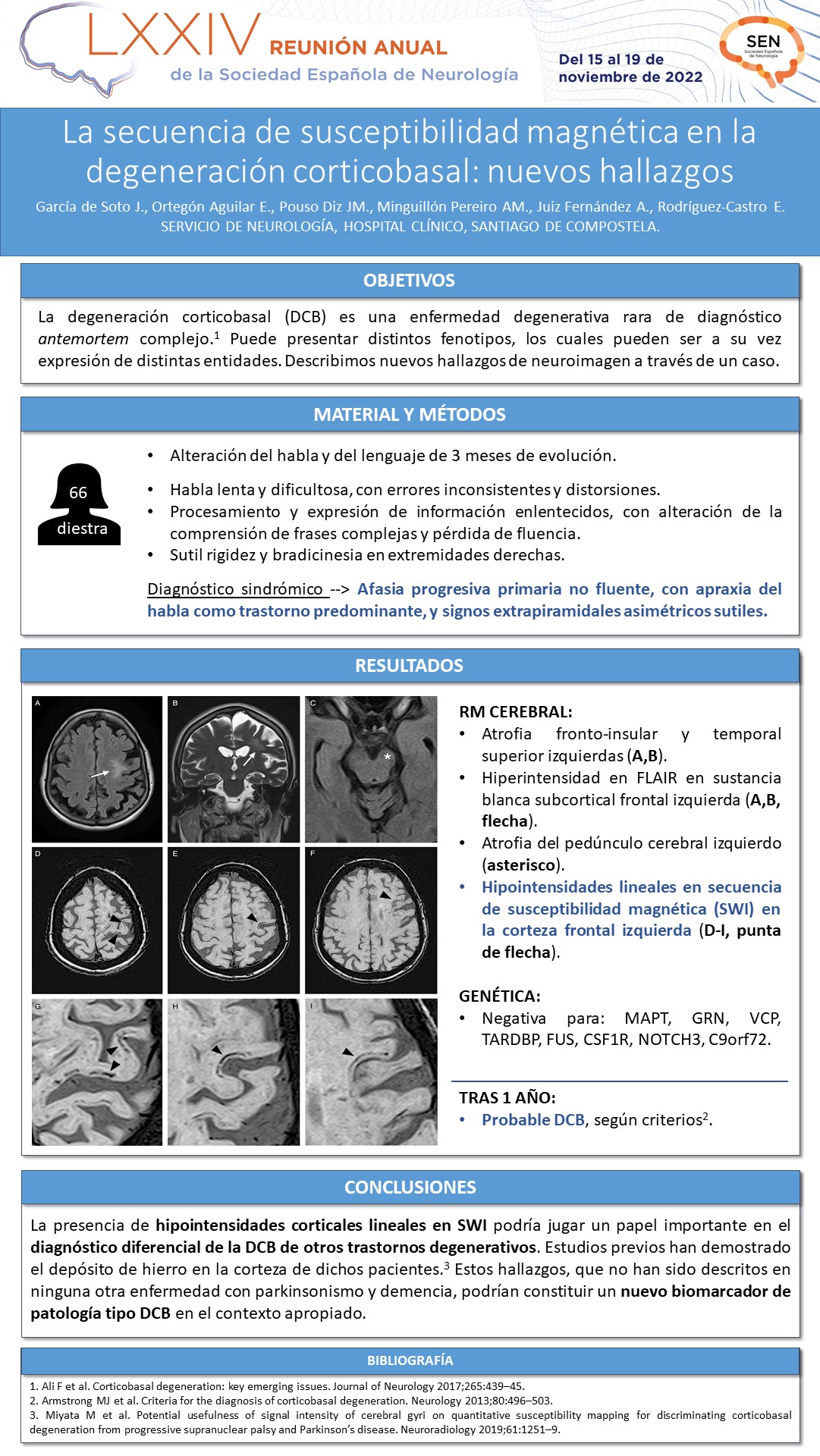 La secuencia de susceptibilidad magnética en la degeneración corticobasal: nuevos hallazgos