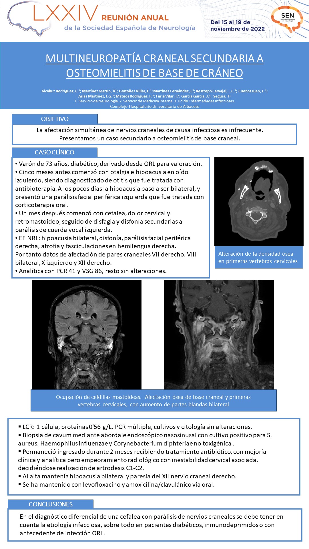 Multineuropatía craneal secundaria a osteomielitis de base de cráneo