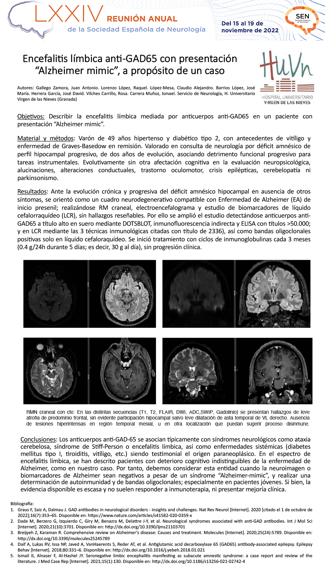 Encefalitis límbica anti-GAD65 con presentación “Alzheimer mimic”, a propósito de un caso