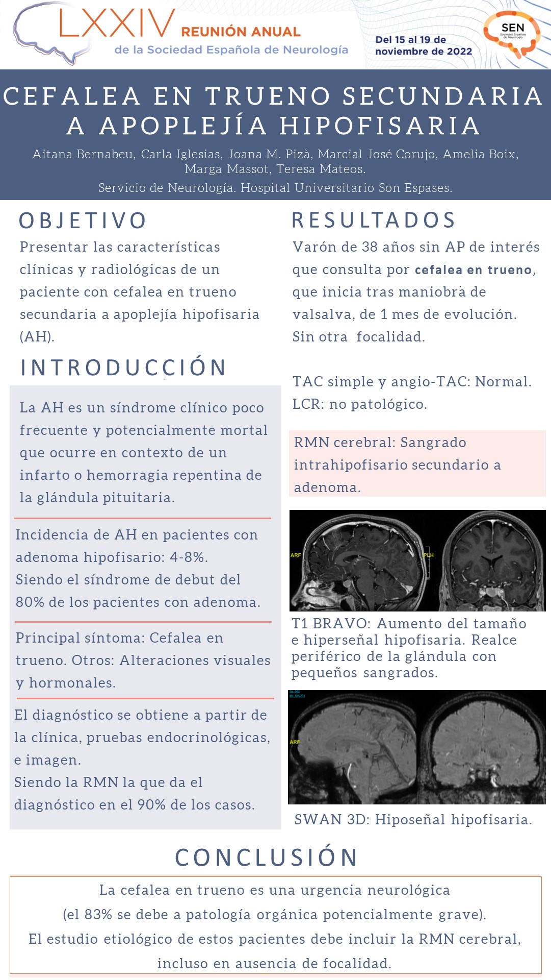 Cefalea en trueno secundaria a apoplejía hipofisaria