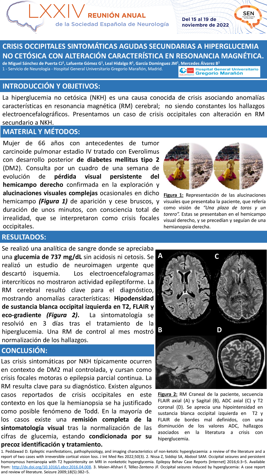 Crisis occipitales sintomáticas agudas secundarias a hiperglucemia no cetósica con alteración característica en resonancia magnética