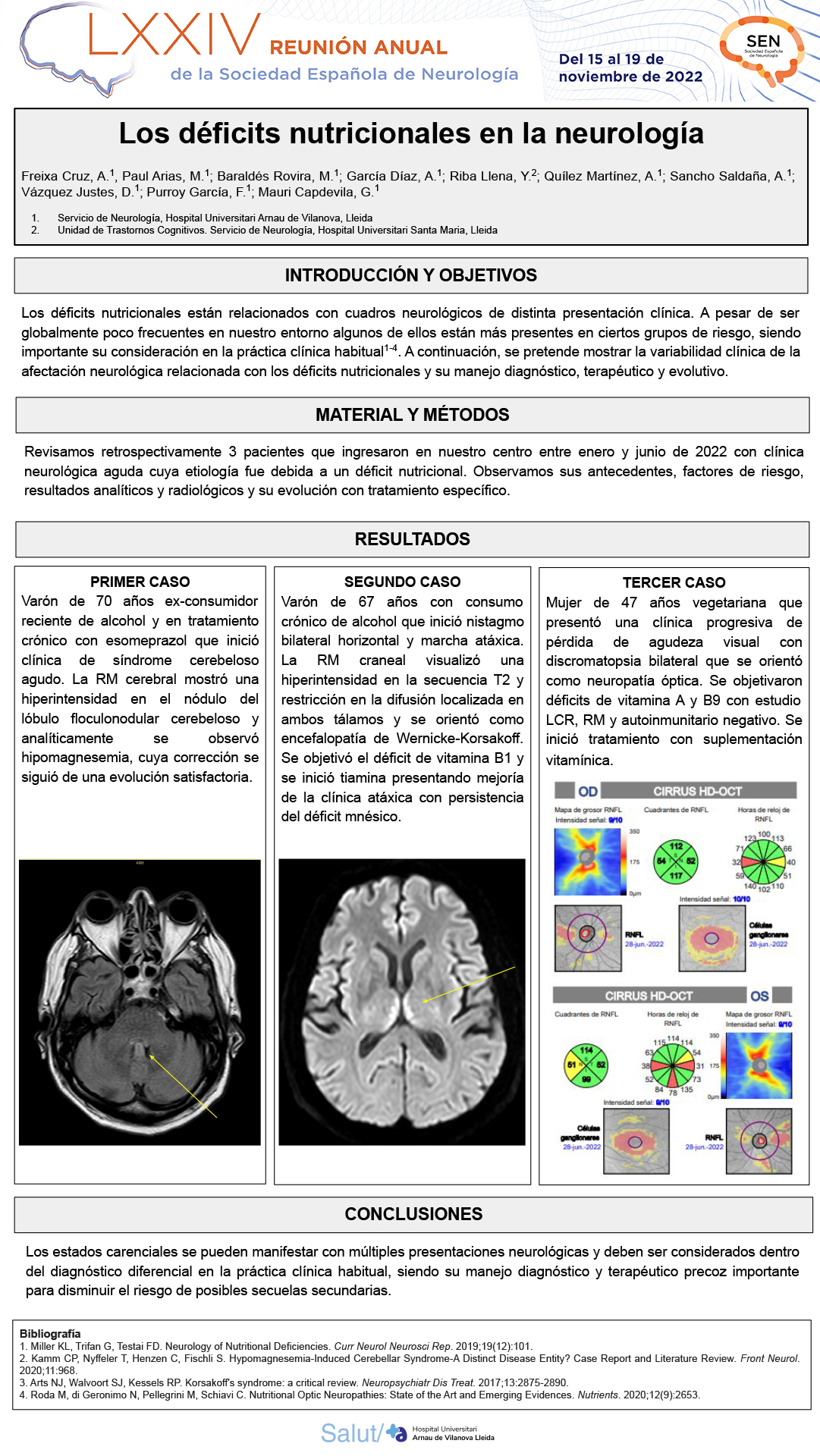 Los déficits nutricionales en la neurología