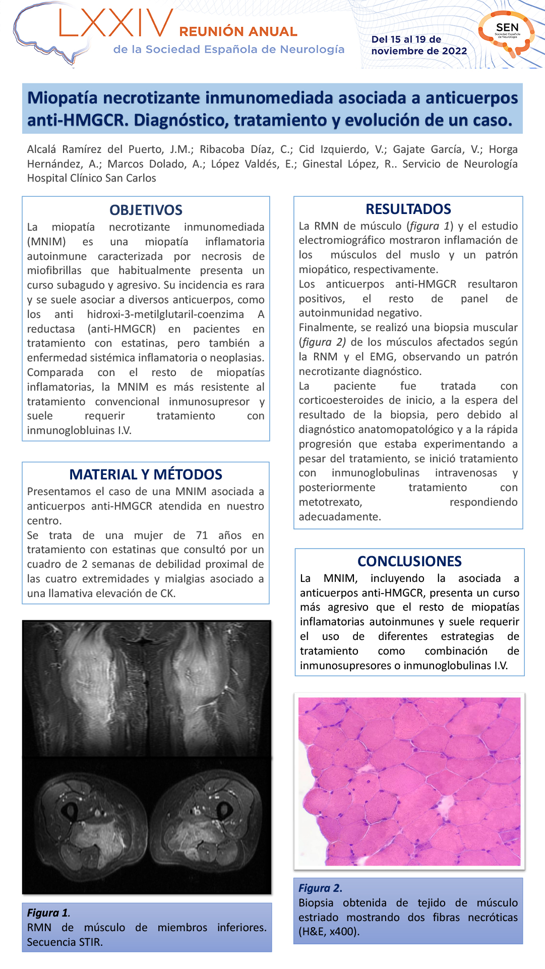 Miopatía necrotizante inmunomediada asociada a anticuerpos anti-HMGCR. Diagnóstico, tratamiento y evolución de un caso