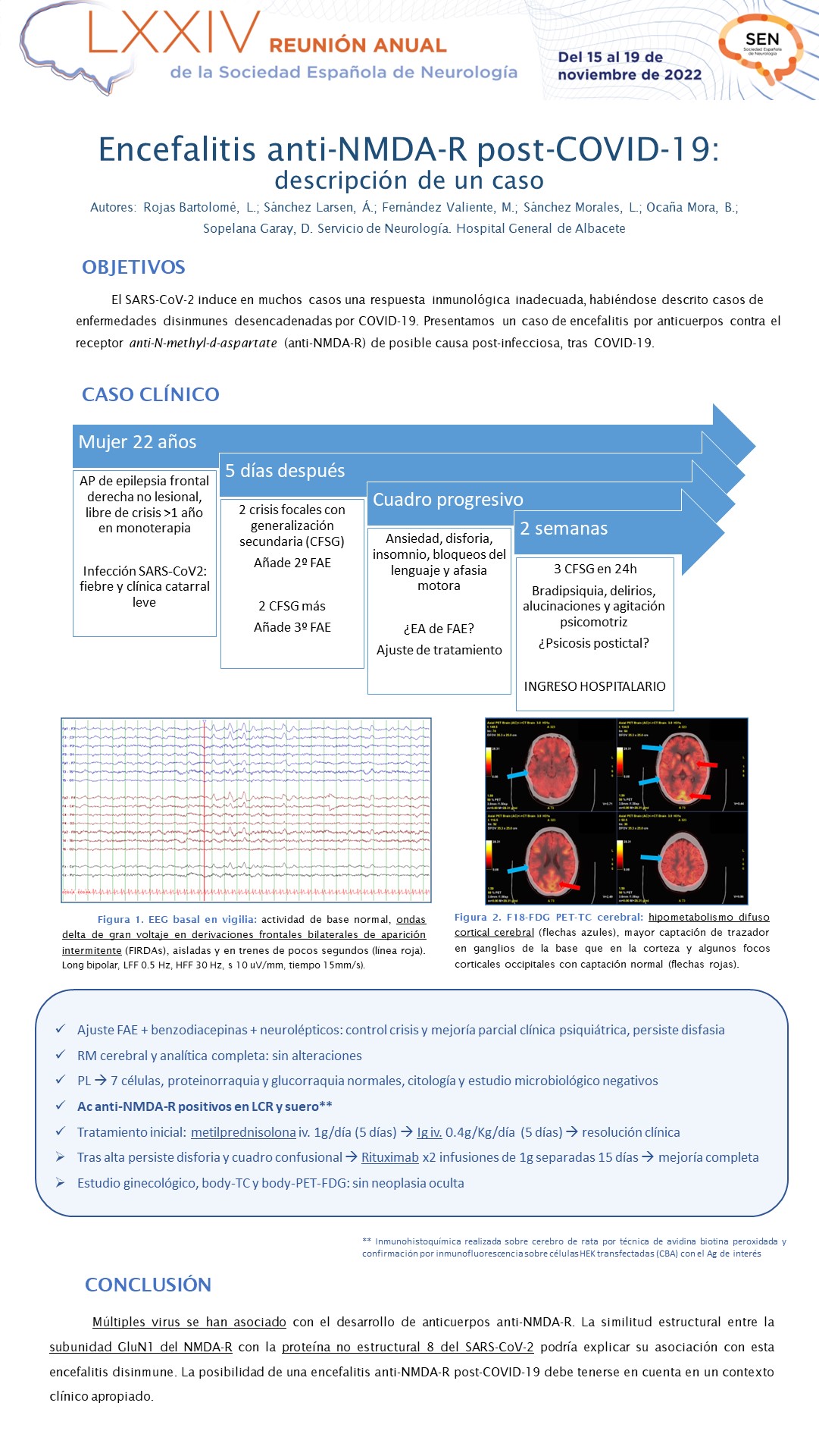 Encefalitis anti-NMDA-R post-COVID-19: descripción de un caso
