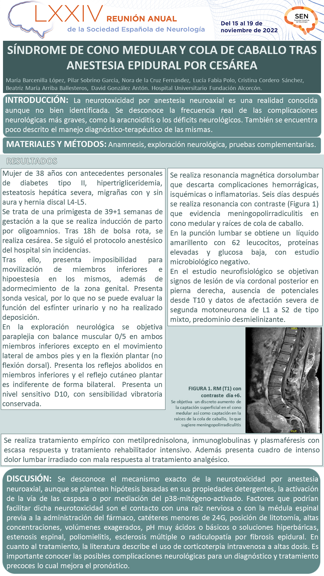 Síndrome de cono medular y cola de caballo tras anestesia epidural por cesárea