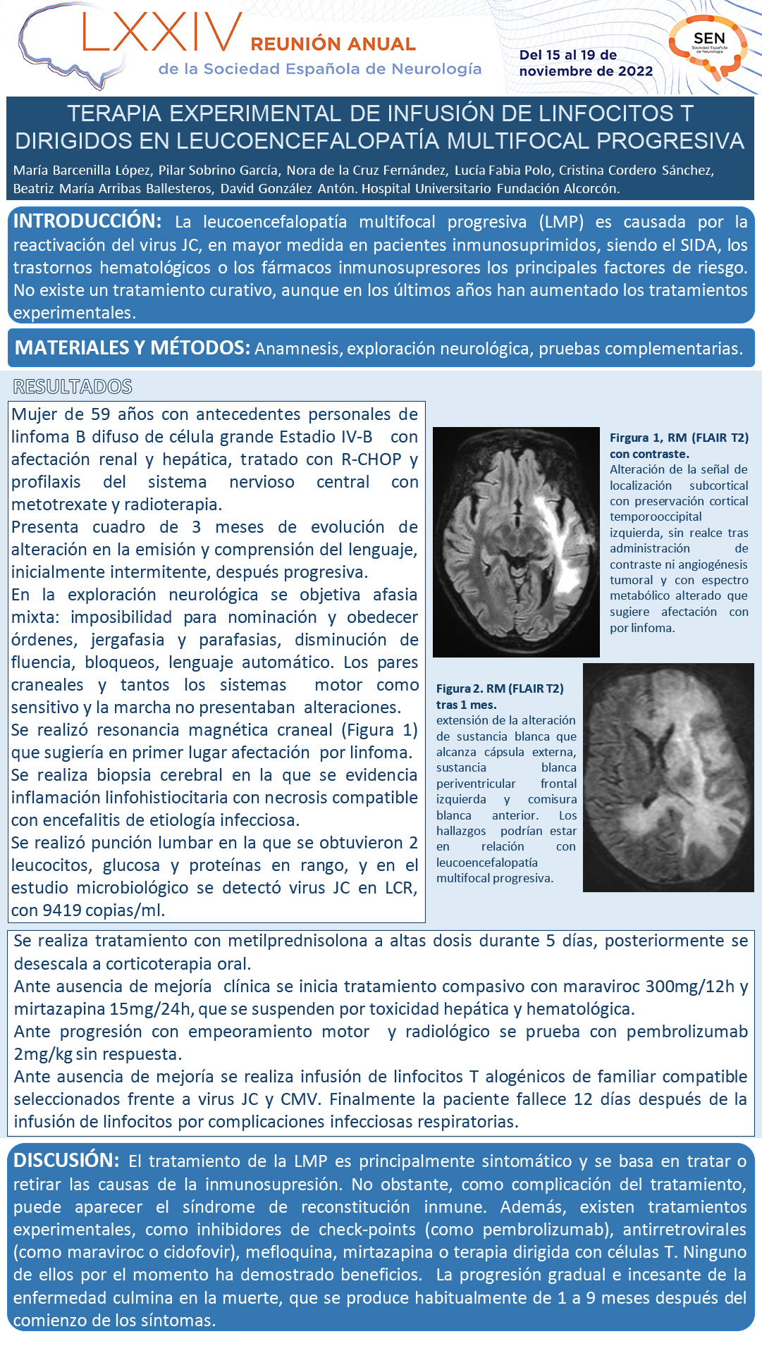 Terapia experimental de infusión de linfocitos T dirigidos en leucoencefalopatía multifocal progresiva