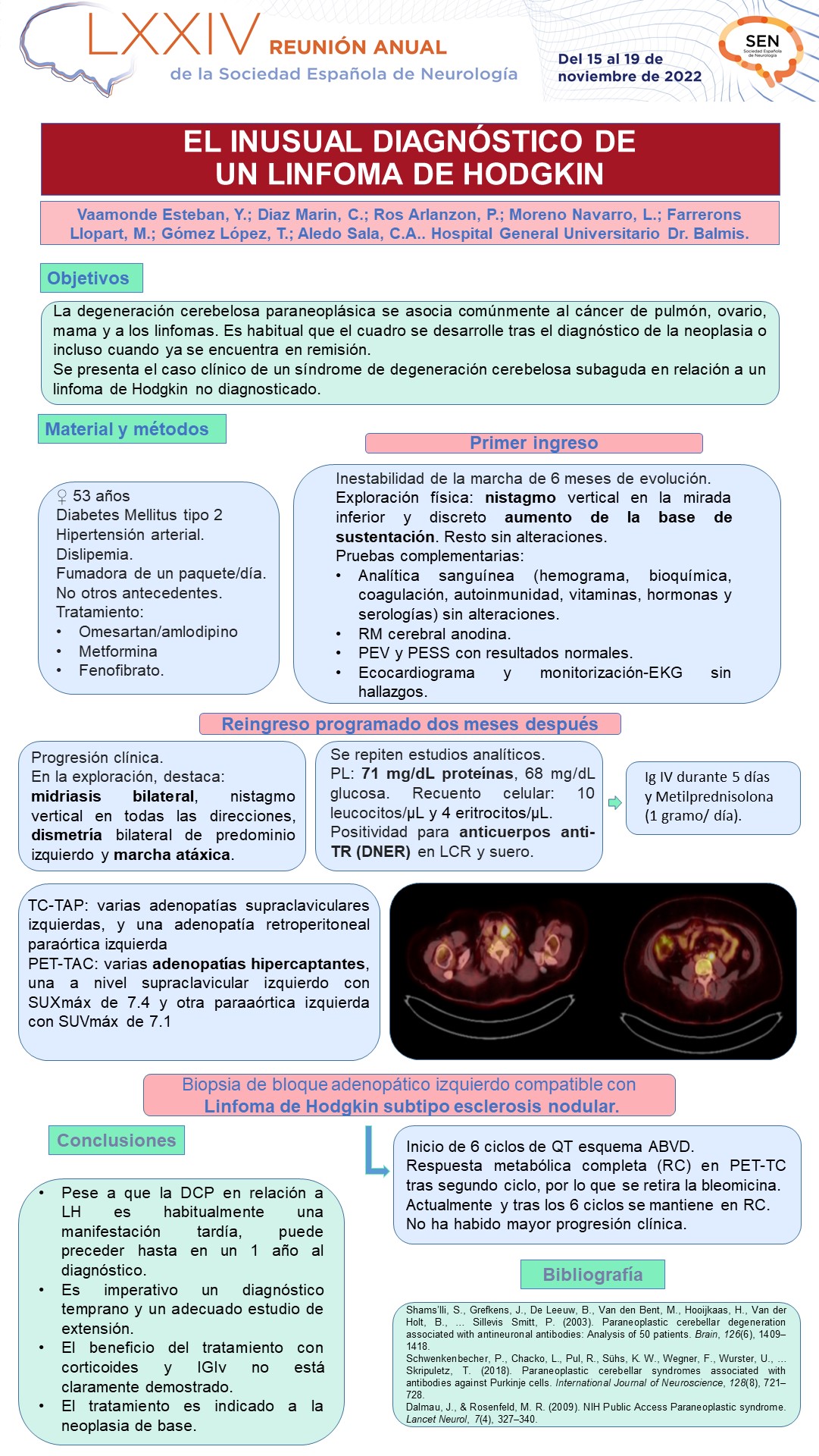 El inusual diagnóstico de un linfoma de Hodgkin