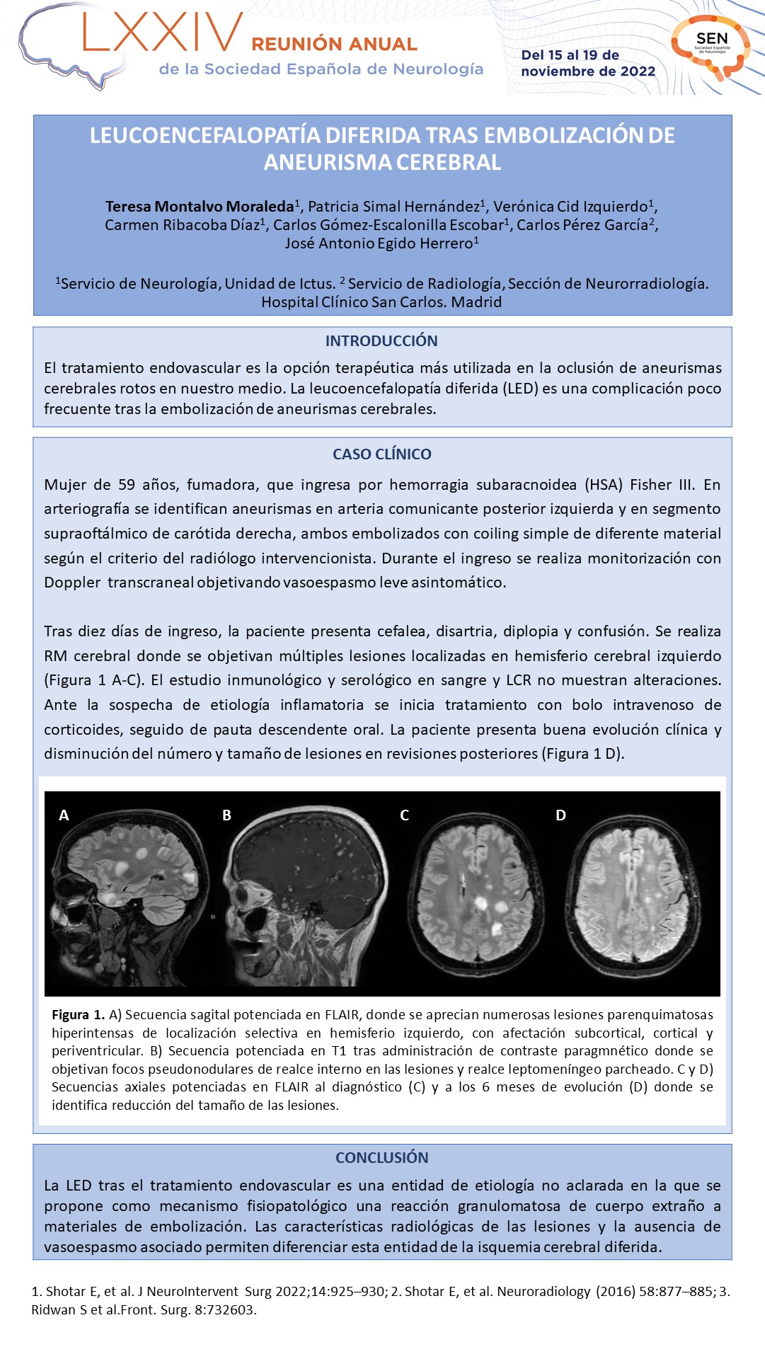 Leucoencefalopatía diferida tras embolización de aneurisma cerebral