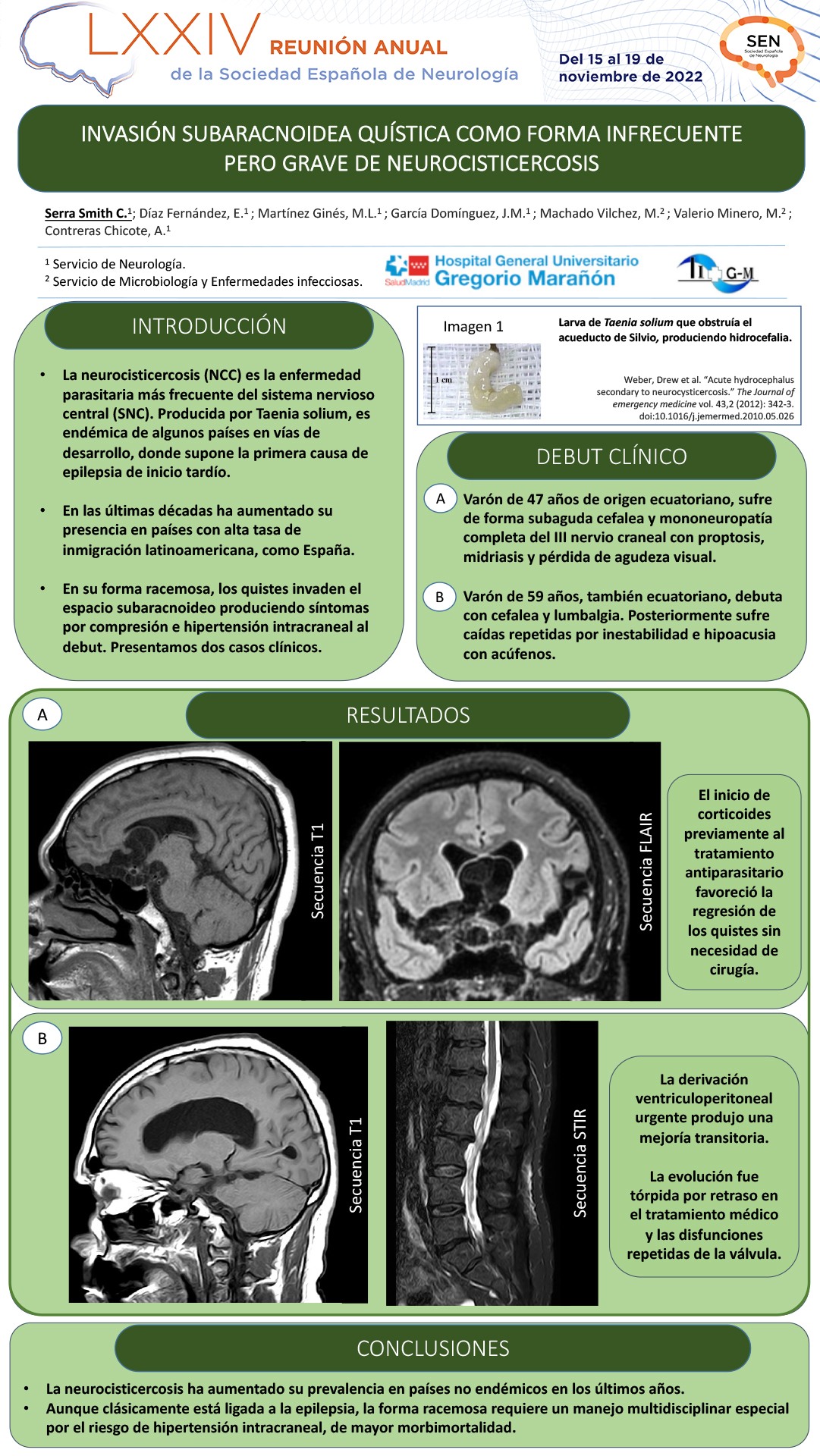 Invasión subaracnoidea quística como forma infrecuente pero grave de neurocisticercosis