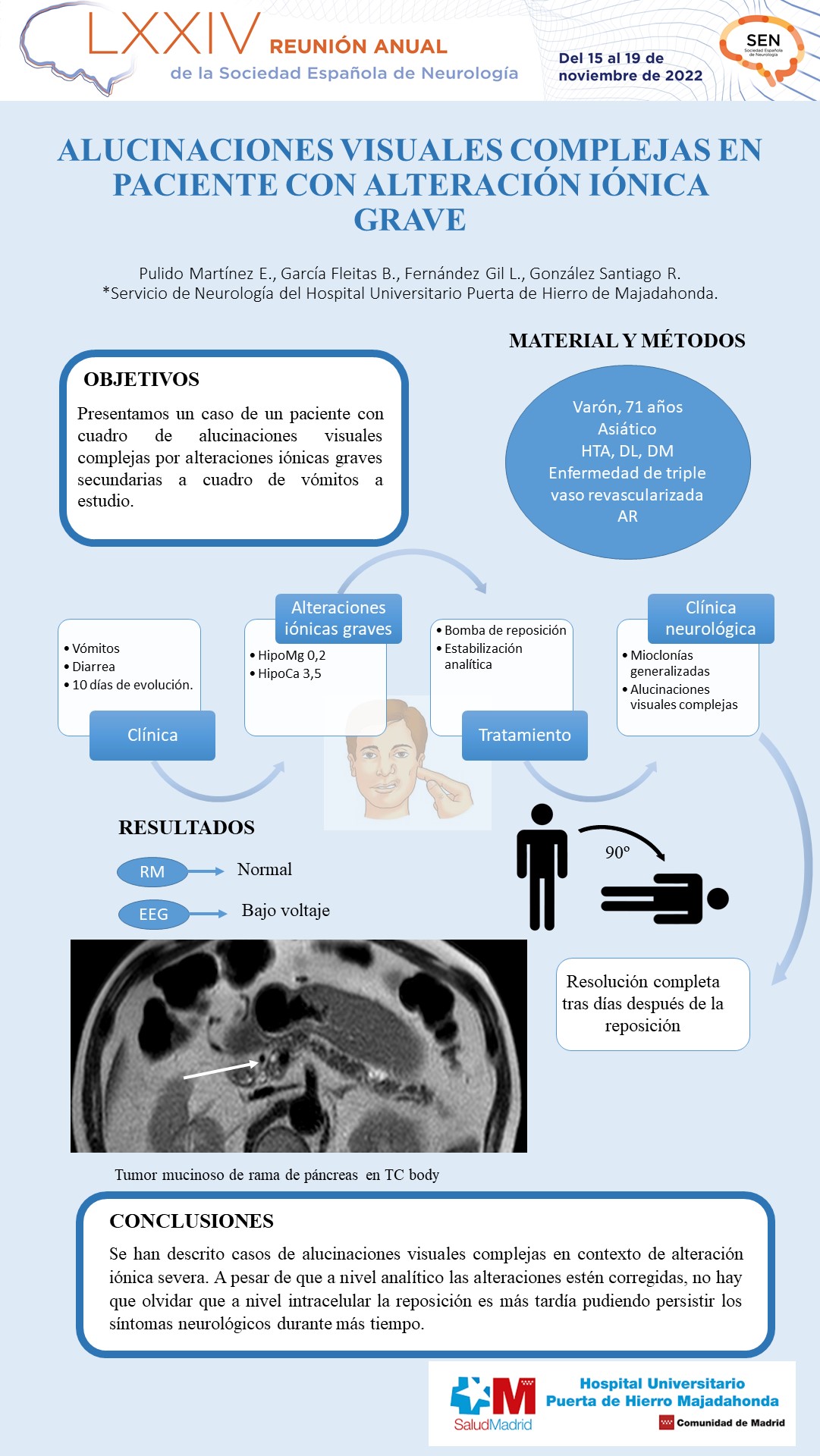 Alucinaciones visuales complejas en paciente con alteración iónica grave