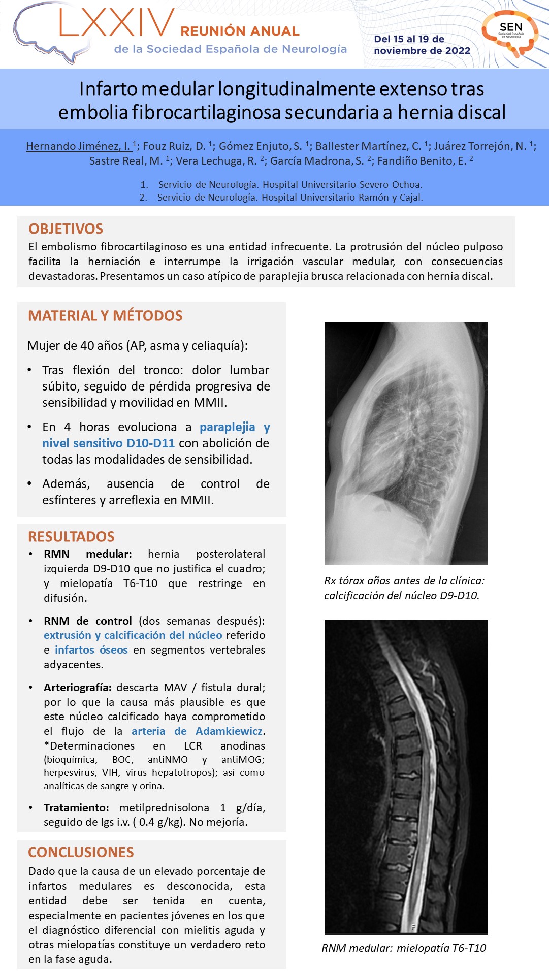 Infarto medular longitudinalmente extenso tras embolia fibrocartilaginosa secundaria a hernia discal