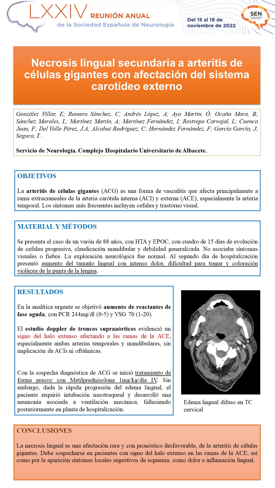 Necrosis lingual secundaria a arteritis de células gigantes con afectación del sistema carotídeo externo